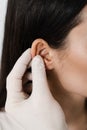 Otoplasty ear surgery close-up. Surgeon doctor examines girl ears before otoplasty cosmetic surgery. Otoplasty surgical