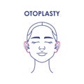 Otoplasty. Ear surgery. Vector illustration of female face. Plastic surgery