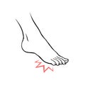 Outline illustration of foot with painful point Royalty Free Stock Photo