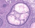 Ovary. Antral or tertiary follicle