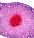 Ovary. Corpus hemorragicum