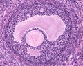 Ovary. Early tertiary follicle Royalty Free Stock Photo