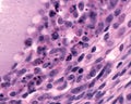 Ovary. Follicular atresia