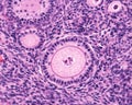 Ovary. Primary follicle