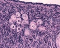 Ovary. Primordial follicles Royalty Free Stock Photo