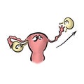 Ovary removal. Uterus is upset.