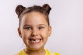 Overexcited young girl smiling with teeth with missing front milk tooth looking at camera on white background. First Royalty Free Stock Photo