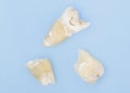 Extracted Molar Tooth On Blue