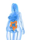 Overweight female - colon