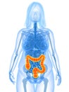 Overweight female - colon