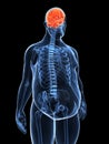 Overweight male - brain Royalty Free Stock Photo