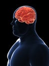 Overweight male - brain Royalty Free Stock Photo