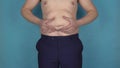 Overweight man with fat belly touches and shakes his abdomen. Obesity, graceless body. Plump or thick guy who eats a lot