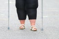 Overweight patient with crutches.