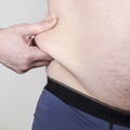 Overweight person pinches himself on the fat side