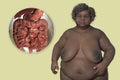 An overweight woman and close-up view of digestive system, 3D illustration