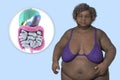 An overweight woman and close-up view of digestive system, 3D illustration