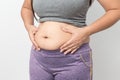 Overweight woman hand pinching excessive belly fat Royalty Free Stock Photo