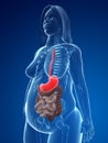 Overweight woman - organs Royalty Free Stock Photo