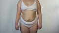 Overweight woman wearing undies posing for camera, obesity, unhealthy nutrition