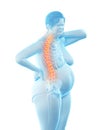 An overweight womans painful back