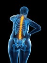 An overweight womans painful back