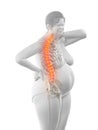 An overweight womans painful back