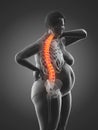 An overweight womans painful back