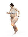 An overweight womans painful joints