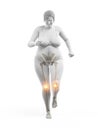 An overweight womans painful joints