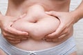 Overweighted woman holding her fat skin folds on a stomach, belly, abdominal obesity and diabetes risk concept