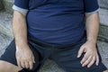 Fat, obese man`s belly close up with diabetes and in ill health outdoors sitting Royalty Free Stock Photo