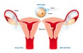 Ovulation, fertilization, implantation of blastocyst in the uterine wall