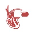 Pacemaker cardio stimulator flat icon