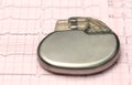 Pacemaker on electrocardiograph Royalty Free Stock Photo