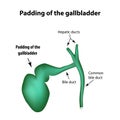 Padding of the gallbladder. Pathology of the gallbladder. Cholecystitis.