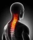 Pain in cervical spine Royalty Free Stock Photo