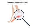 Pain of the heel