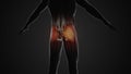 Pain and injury in the Gluteus Maximus Muscles