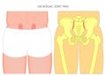 Pain in the joint_Sacroiliac Joint Pain male