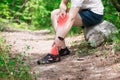 Pain in knee, joint inflammation, massage of male leg, injury while running, trauma during workout Royalty Free Stock Photo