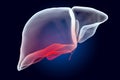 Pain in Liver or Gallbladder concept. Ghost light effect, x-ray hologram. 3D rendering Royalty Free Stock Photo