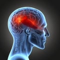 pain medical head anatomy blue red x-ray brain medicine headache. Generative AI. Royalty Free Stock Photo