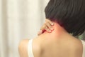 Pain in the nape of the neck Royalty Free Stock Photo