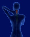 Pain in the neck x-ray scan rear view Royalty Free Stock Photo