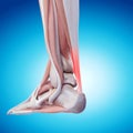 Painful achilles tendon Royalty Free Stock Photo