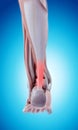 Painful achilles tendon Royalty Free Stock Photo