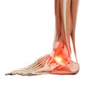 A painful ankle Royalty Free Stock Photo