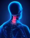 Painful Cervical Spine