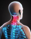 Painful Cervical Spine